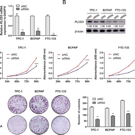 Down Regulation Of Plcd3 Suppresses The Proliferation And Colony