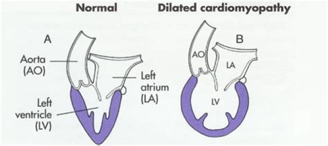 Ch 10 Cardiac Pathophys Flashcards Quizlet