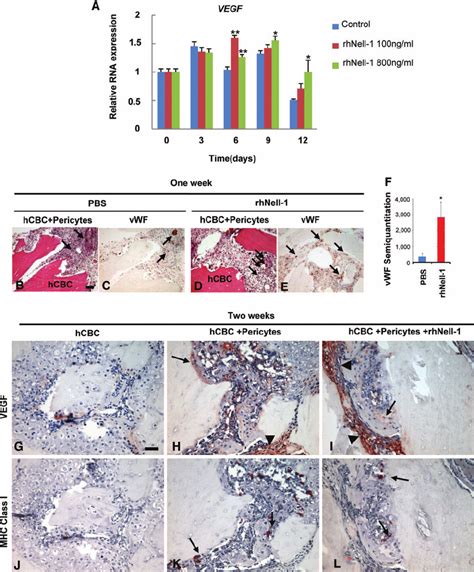 Angiogenic Effects Of Purified Human Pericytes During Osteoblastic