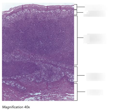 Diagram Of Lab Exam Histology Adrenal Glands Quizlet