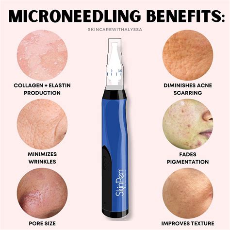 Microneedling Promotes Collagen Levels The Building Blocks Of Our Skin