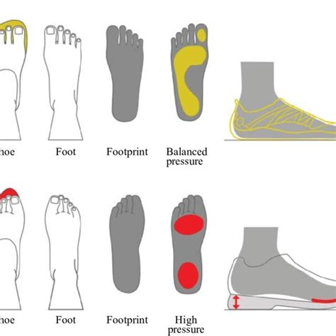 Anatomically Shaped Shoes Permit Biologically Normal Structure And Download Scientific Diagram