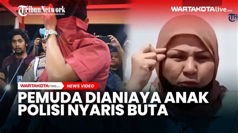 Ken Admiral Pemuda Yang Dianiaya Anak Polisi Akbp Achiruddin Hasibuan