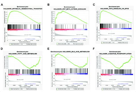 TM4SF1 Facilitates Epithelial Mesenchymal Transition In PTC Based On