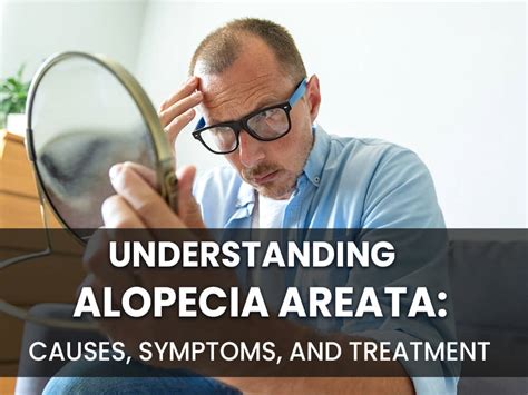 Alopecia Areata Causes Symptoms And Treatment Estenove