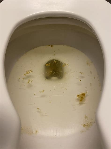 Does This Look Like Steatorrhea Rpoop