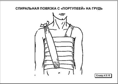 Повязки при травмах различной локализации — Студопедия