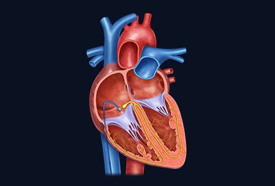 Electrophysiology - Melbourne Heart Group