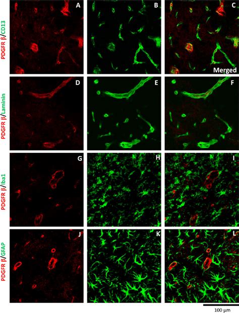 Double Immunofluorescence Staining For PDGFRb And CD13 Laminin Iba1