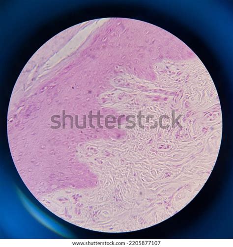 Photo Human Skin Tissue Under Microscope Stock Photo 2205877107 ...