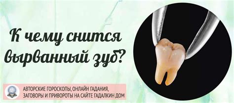 К чему снится вырванный зуб