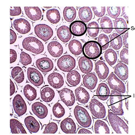 Male Reproductive Histology Lab Flashcards Quizlet