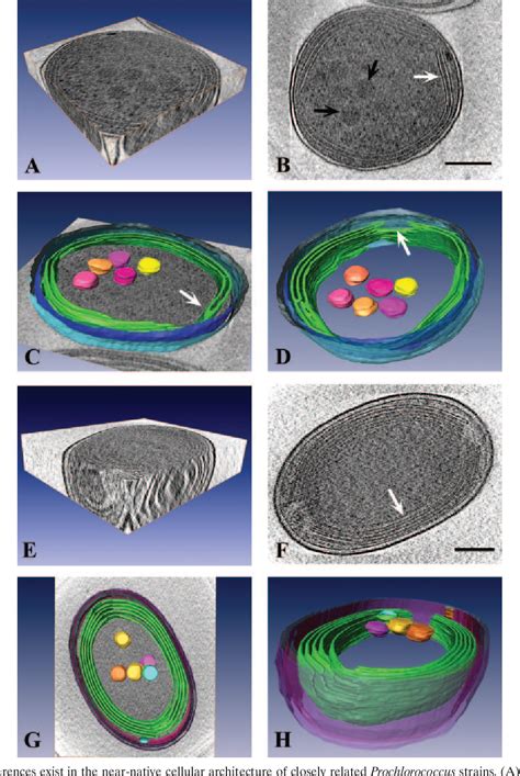 Figure From Cryo Electron Tomography Reveals The Comparative Three