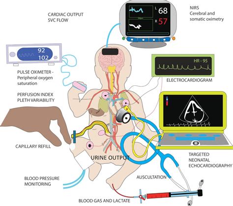 Management Of Systemic Hypotension In Term Infants With Persistent