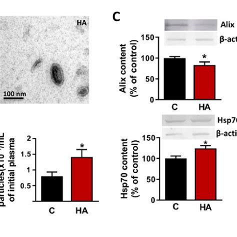 Characterization Of Extracellular Vesicles Isolated From Plasma Of