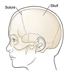 Understanding Skull Fracture (Child) | Saint Luke's Health System