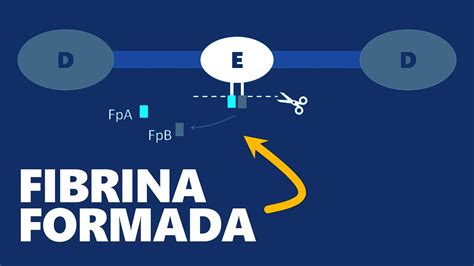 Fibrinog Nio Plasm Tico Interpreta O De Exames Youtube