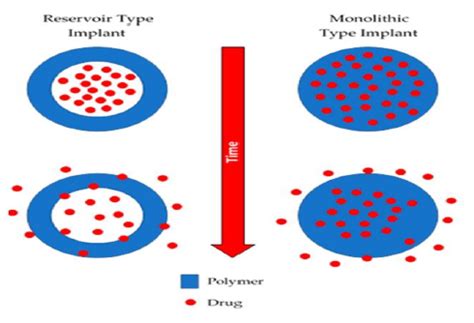 Implantable Drug Delivery System An Overview IJPPR