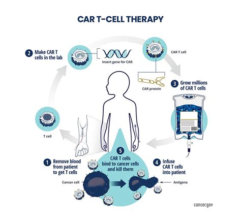 Car T Cell Therapy Infographic Nci