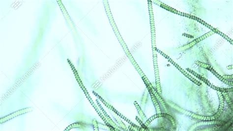 Microscopic View Of Spirulina Sp Blue Green Algae As They Rotate And