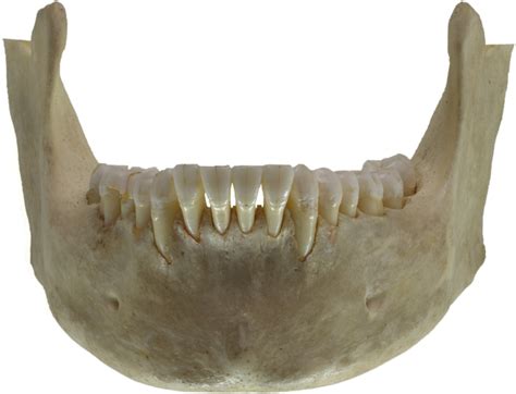 Mandible - wikidoc
