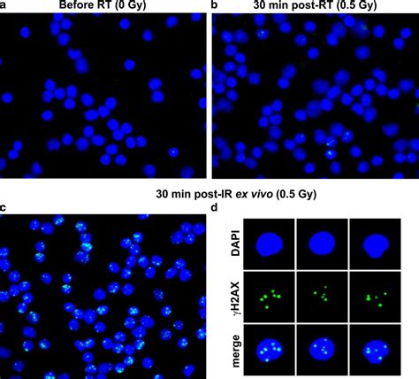 Immunofluorescence staining for γH2AX green in DAPI stained blue