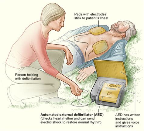 National Cpr And Aed Awareness Week R G Medical Legal Solutions Llc