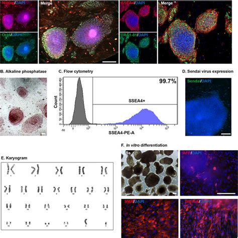 Characterization Of The Ipsc Line Csc 43j Download Scientific Diagram