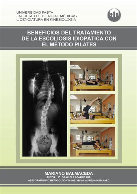 Pdf Beneficios Del Tratamiento De La Escoliosis IdiopÁtica · La Escoliosis Idiopática Del