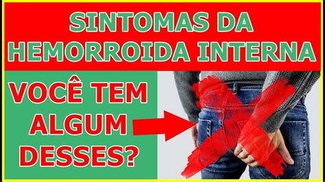 Sintomas Mais Comuns Na Hemorroida Interna Voc Tem Algum Desses