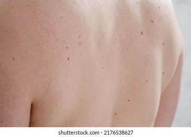 Naked Mole Images Stock Photos Vectors Shutterstock