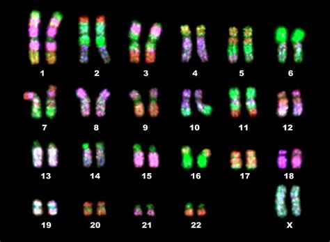 Fluorescence Lm Of A Normal Human Female Karyotype Photograph by Dept. Of Clinical Cytogenetics ...