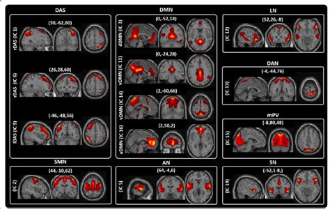 Resting State Networks Rsns Identified By Gift Thirteen Spatial Maps