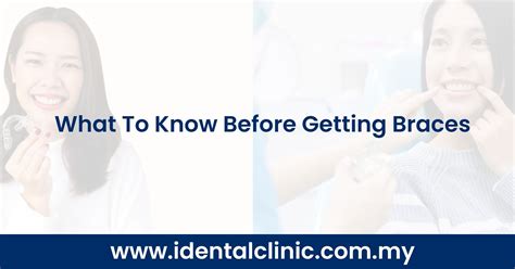 What To Know Before Getting Braces Idental Clinic