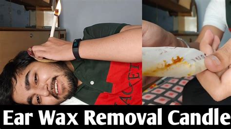 Ear Wax Removal Candle How To Use At Home Youtube