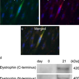 Expression Of Dystrophin Mrna In The Ftcvs During Myogenic Induction A