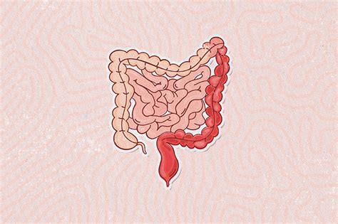 The Facts About Ulcerative Colitis Treatments And Procedures