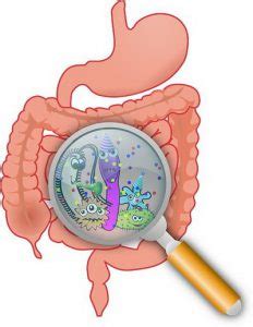 Colon Infection - Causes, Symptoms, Treatment