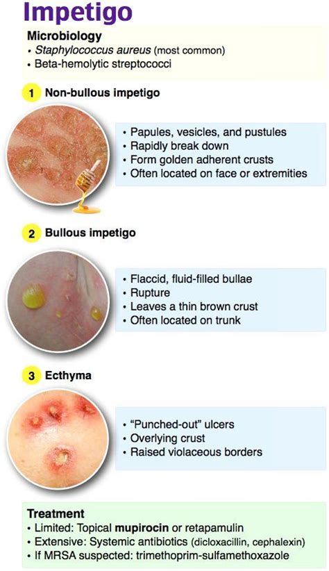 Adam Rosh Md On Twitter Impetigo Dermatology Nurse Pediatric Nurse