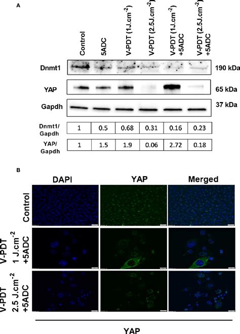 Figure From Combination Of Verteporfin Photodynamic Therapy With