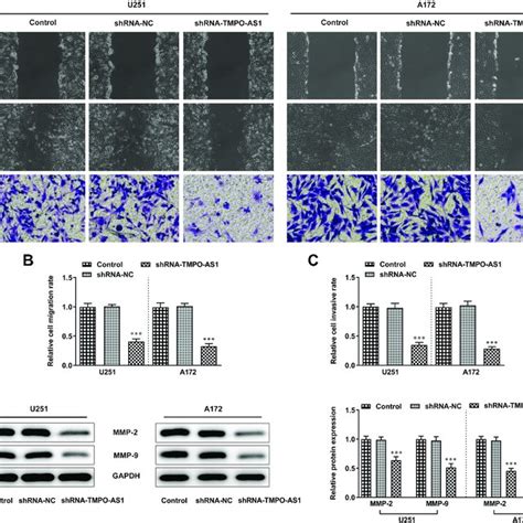 Knockdown Of Tmpo As1 Suppressed Glioma Cell Migration And Invasion