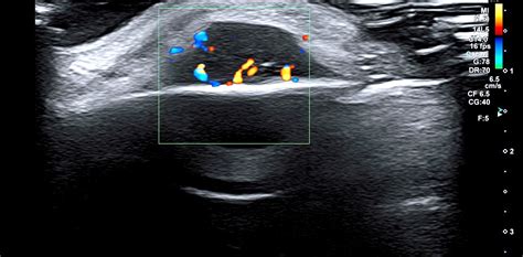 Dr Mazzamuto Centre de radiographie à Jodoigne Echographie doppler