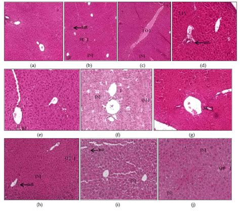 Histopathological Photomicrographs Hande 400× Of Liver Tissues Showing