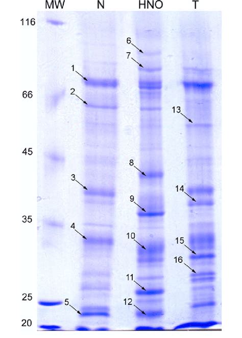 SDSPAGE Analysis Of Extracellular Sugar Beet Proteins Each Lane