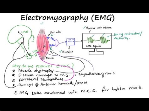 EMG II Electromyography II Muscle Electrical Activity YouTube