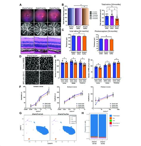 Dram2 Loss Causes Very Mild Age Related Photoreceptor Degeneration With