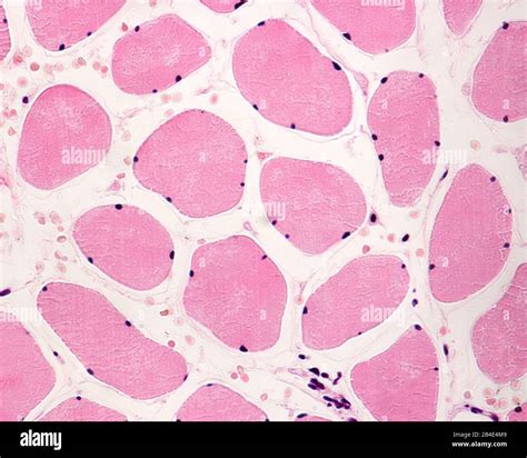 Skeletal Striated Muscle Fibers In Cross Section Showing The Presence