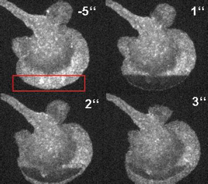 Fluorescence Recovery After Photobleaching FRAP Ibidi