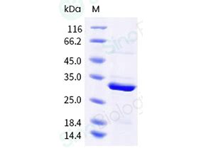 Recombinant Human Gzmk Granzyme K Protein H H Sino Biological