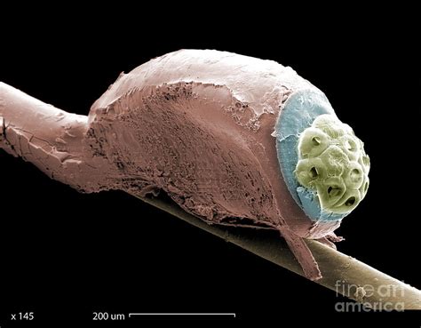 Sem Of A Head Lice Eggs Photograph by Ted Kinsman